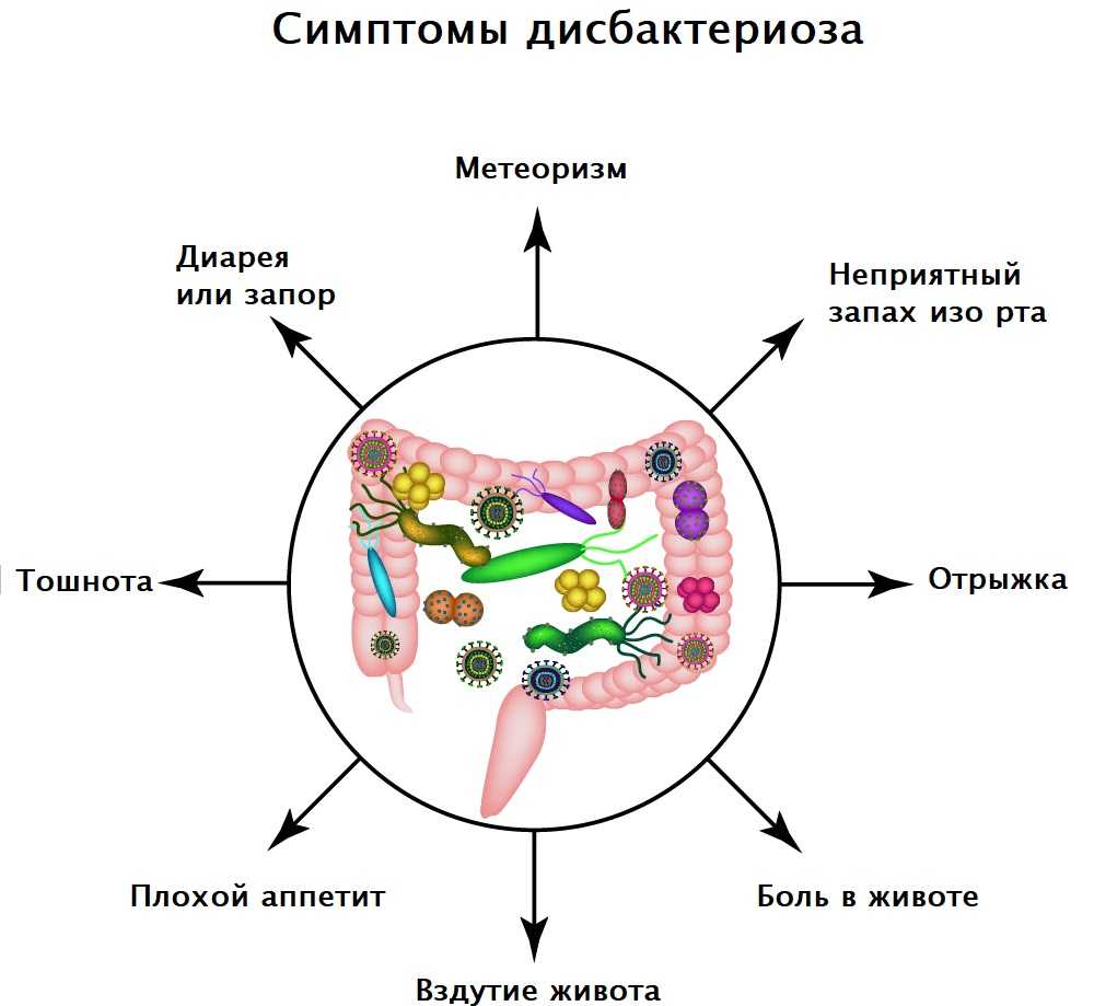 Дисбактериоз
