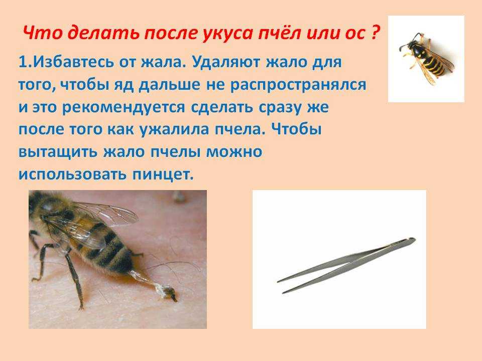 Как жалит оса и как извлечь жало? что нужно делать если укусила оса? первая помощь