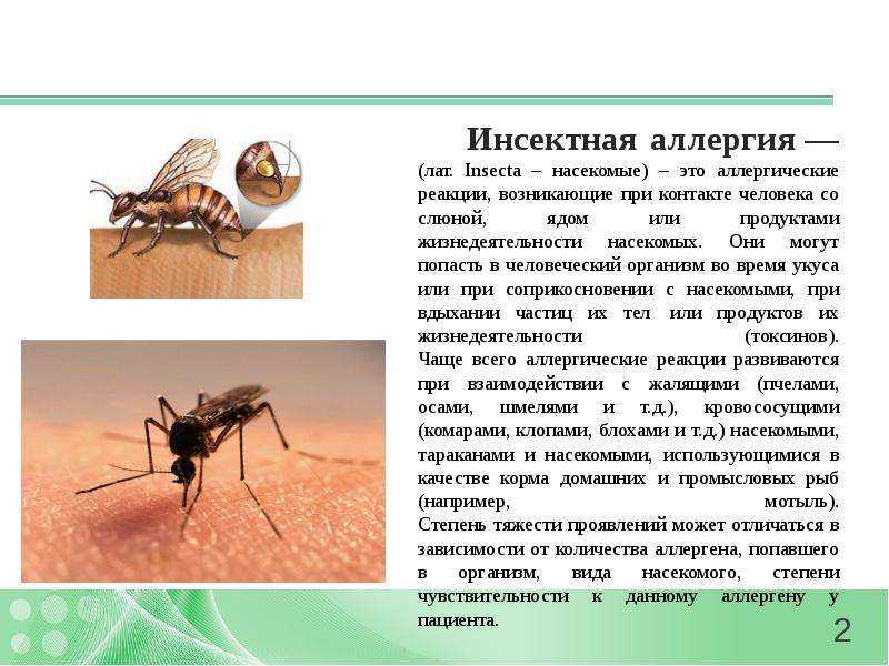 Реакции на ужаления насекомых - как проявляются и что делать?