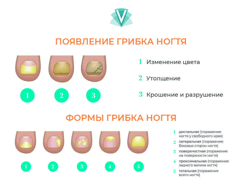 Рамуляриоз листьев роз - лечение заболевания, профилактика | розоцвет