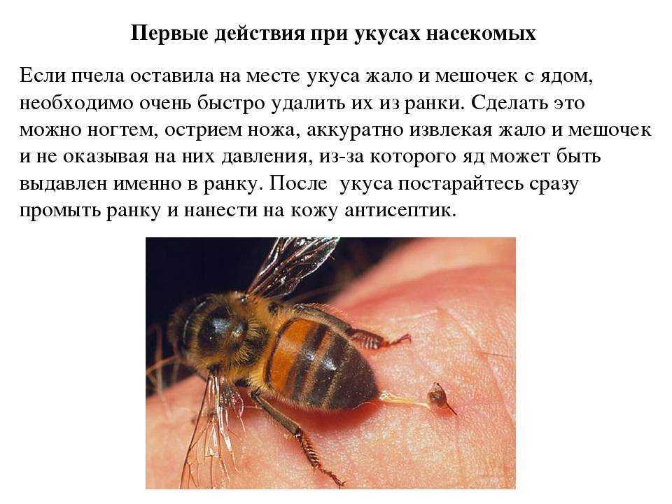 Оставляет ли оса свое жало при укусе, как узнать осталось ли жало в человеке