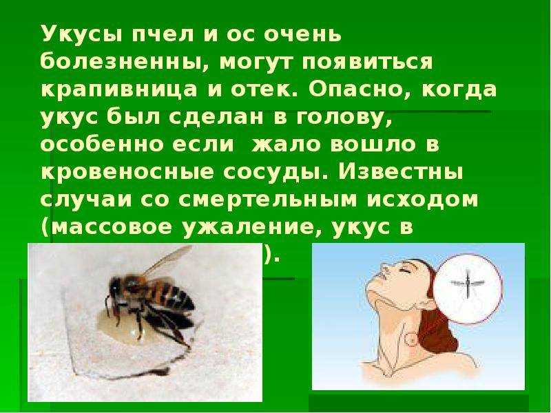 Что делать при укусе пчелы?