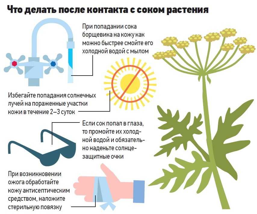 Мази и кремы от ожогов