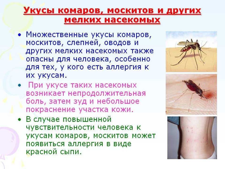 Реакции на ужаления насекомых