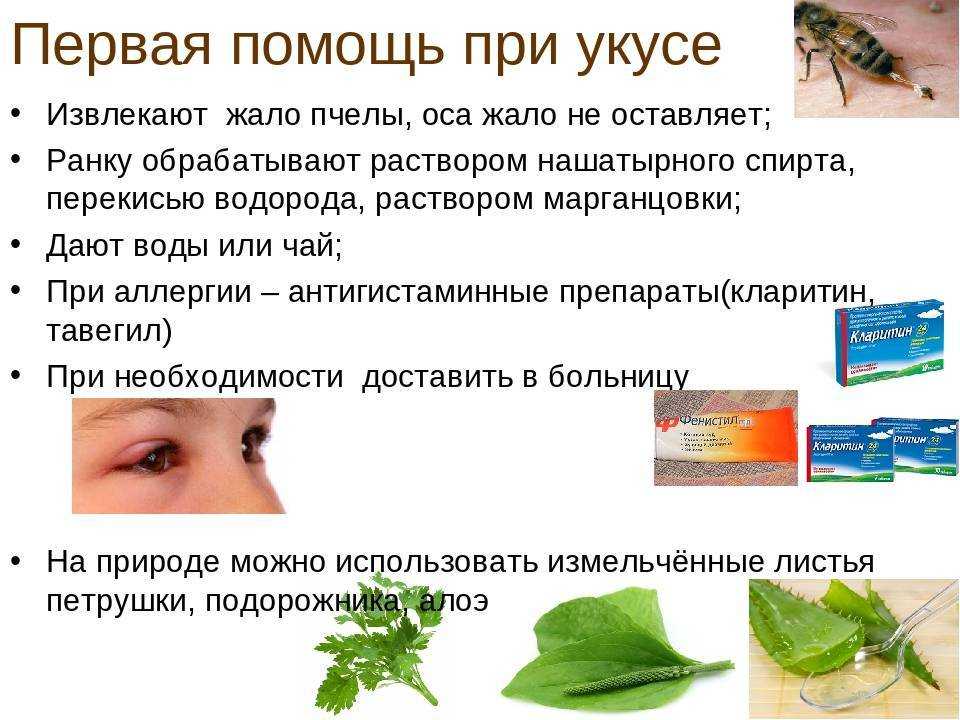 Первая помощь при укусе пчелы: что делать и как снять отек?