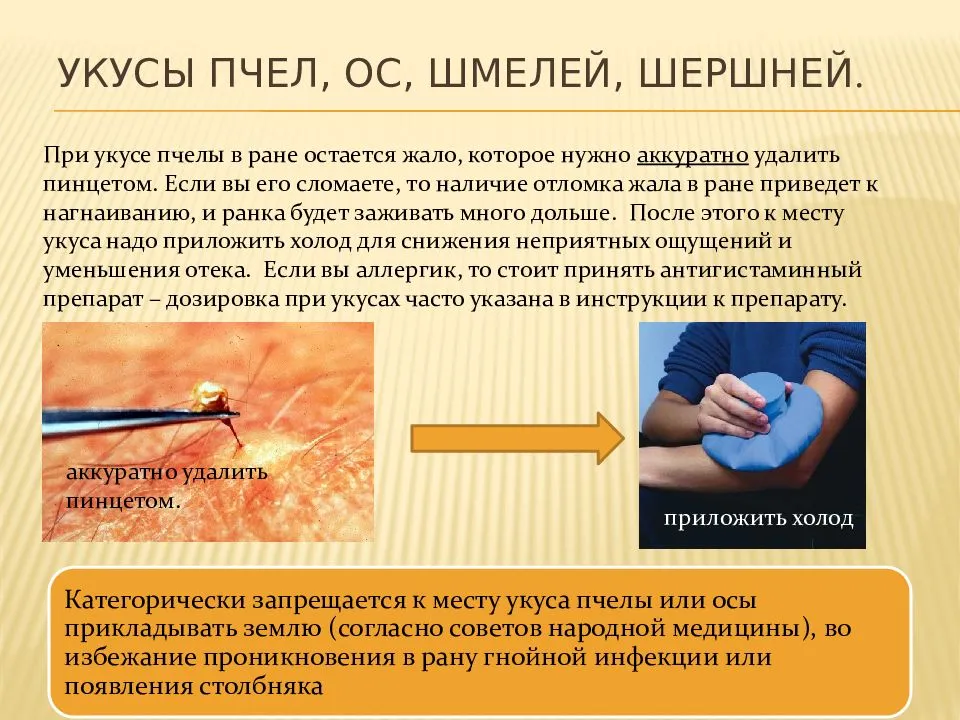 Опухоль от укуса пчелы