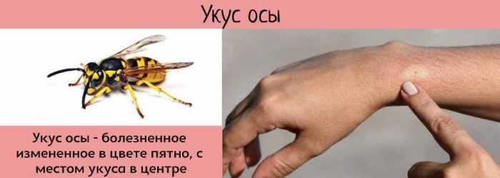 Укус шершня описание, опасность для человека, осложнения, первая помощь