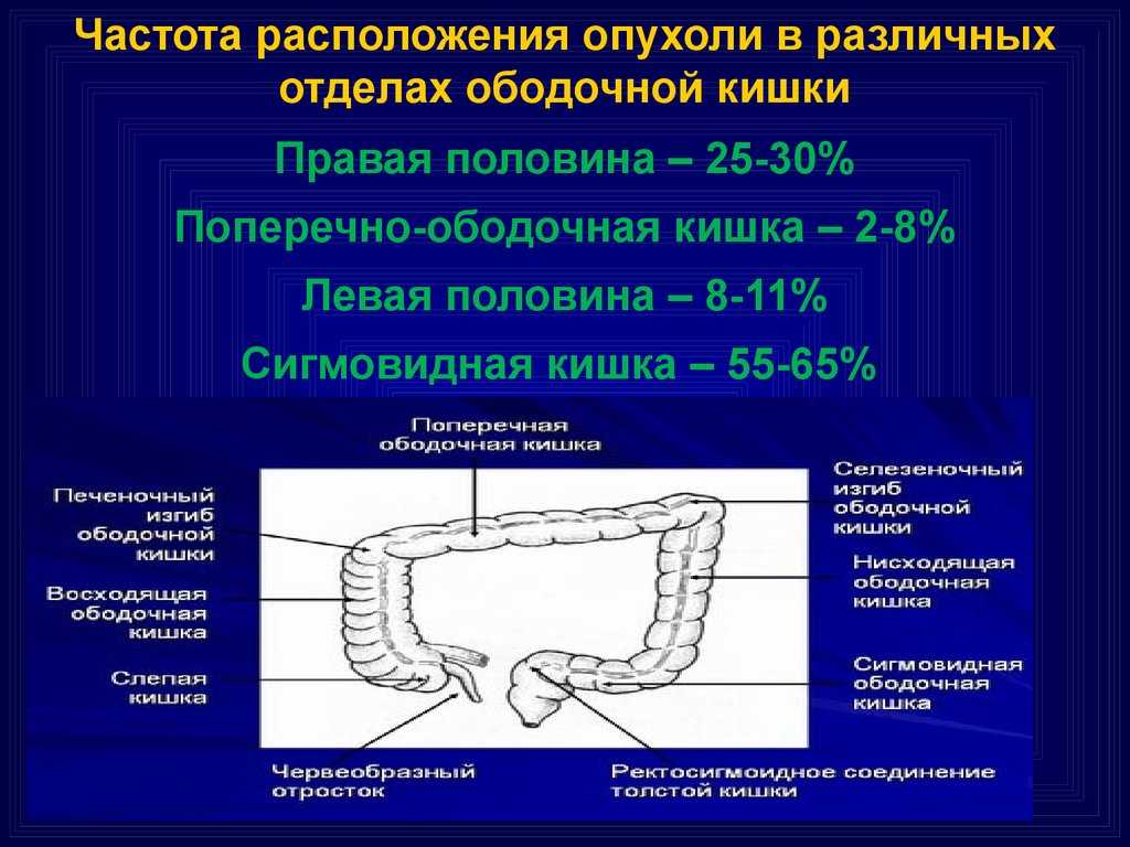 Причины и лечение черного рака у яблони — фото болезни