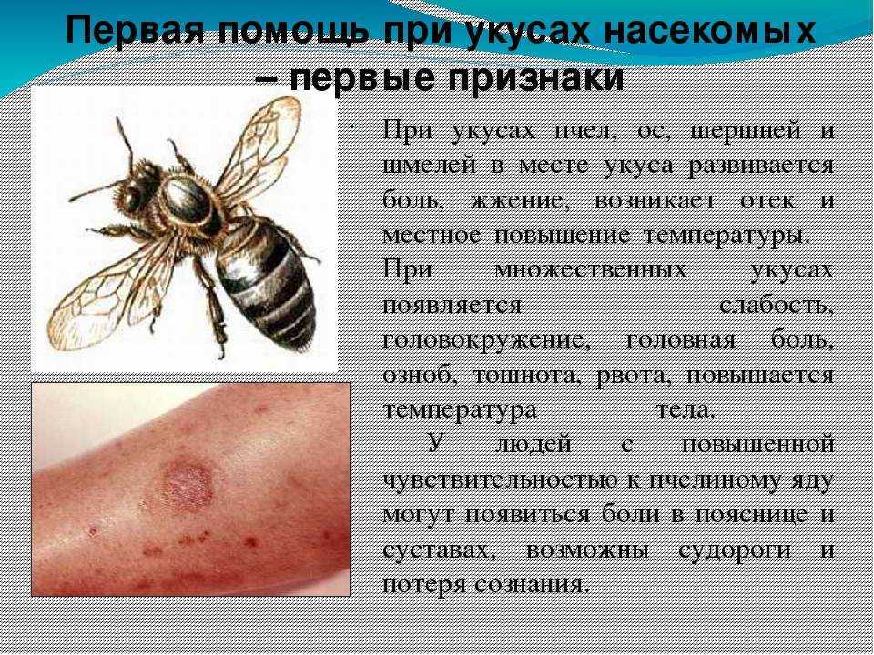 Умирает ли оса после укуса – что происходит с ее жалом